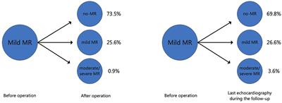 The fate of concomitant mild mitral regurgitation in aortic insufficiency: A neglected subject